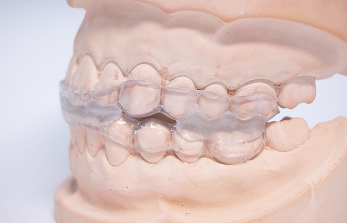 スポーツとかみ合わせ_マウスガードの起源