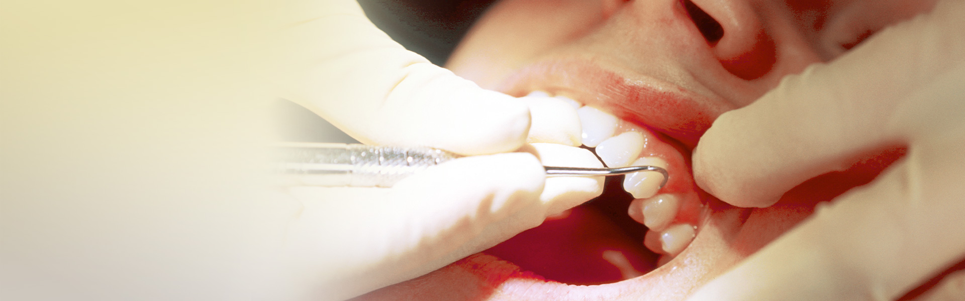 歯周病_ヘッダー