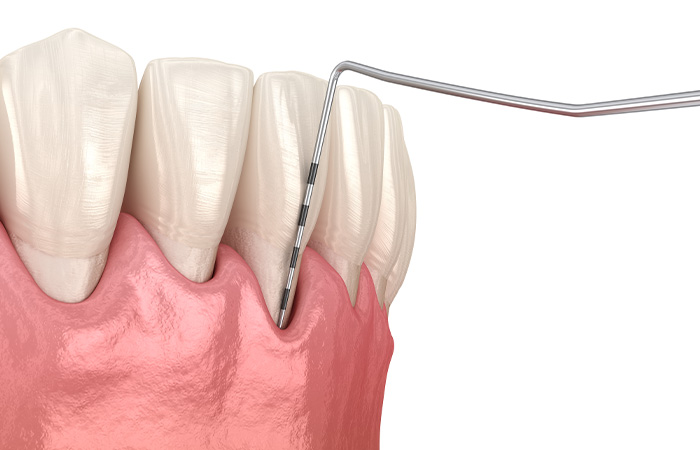 治療の流れ_検査