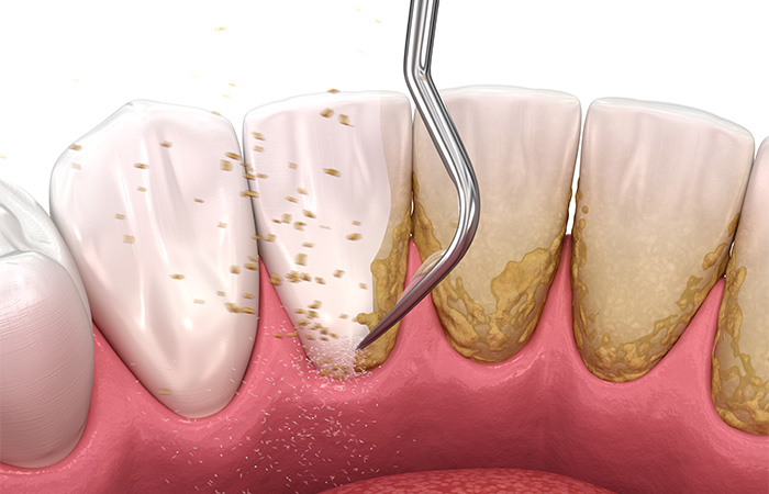 治療の流れ_初期治療