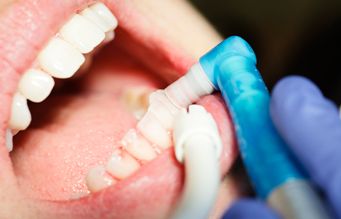 治療の流れ_メンテナンス・定期管理