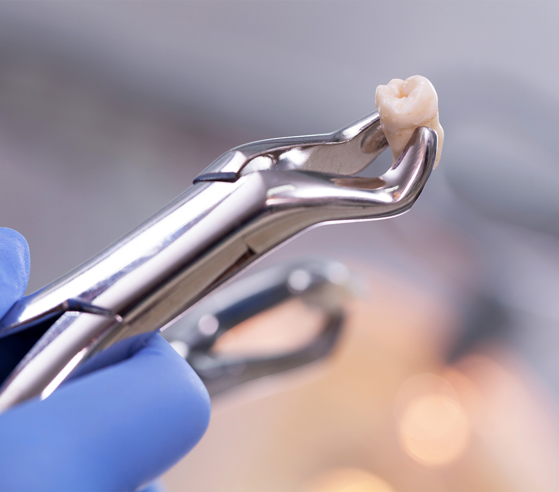 診療案内_歯科口腔外科（親知らず・顎関節症・歯ぎしり・食いしばり）