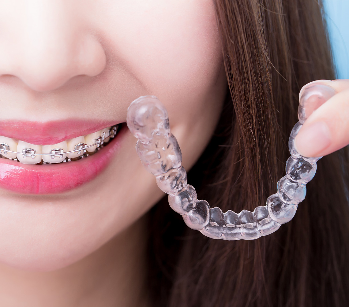 診療案内_矯正歯科・小児矯正